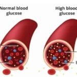 Diabetes Herbal Medication – Blood Sugar Support 1