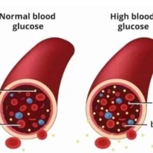 Diabetes Herbal Medication – Blood Sugar Support