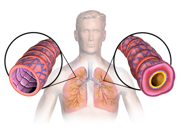 Asthma & Respiratory
