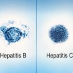 Hepatitis B & C Herbal Medication – Liver Health Support 1