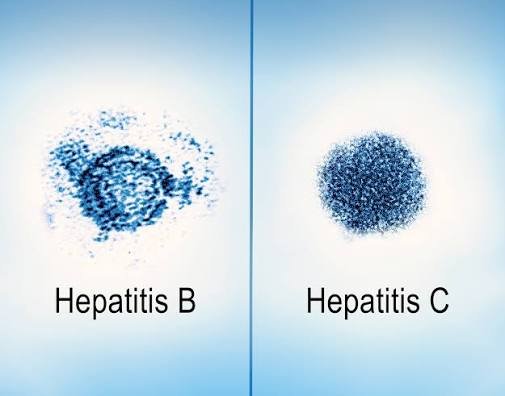 Hepatitis B & C