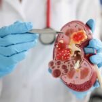 Kidney Herbal Medication – Kidney & Urinary Support 1