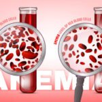 Anemia Herbal Medication – Blood & Vitality Support 1
