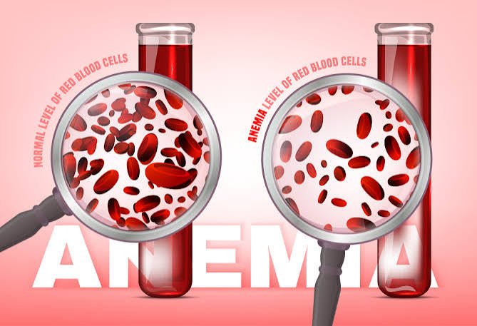 Anemia Herbal Medication – Blood & Vitality Support