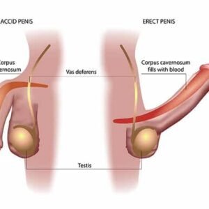 Erectile Dysfunction